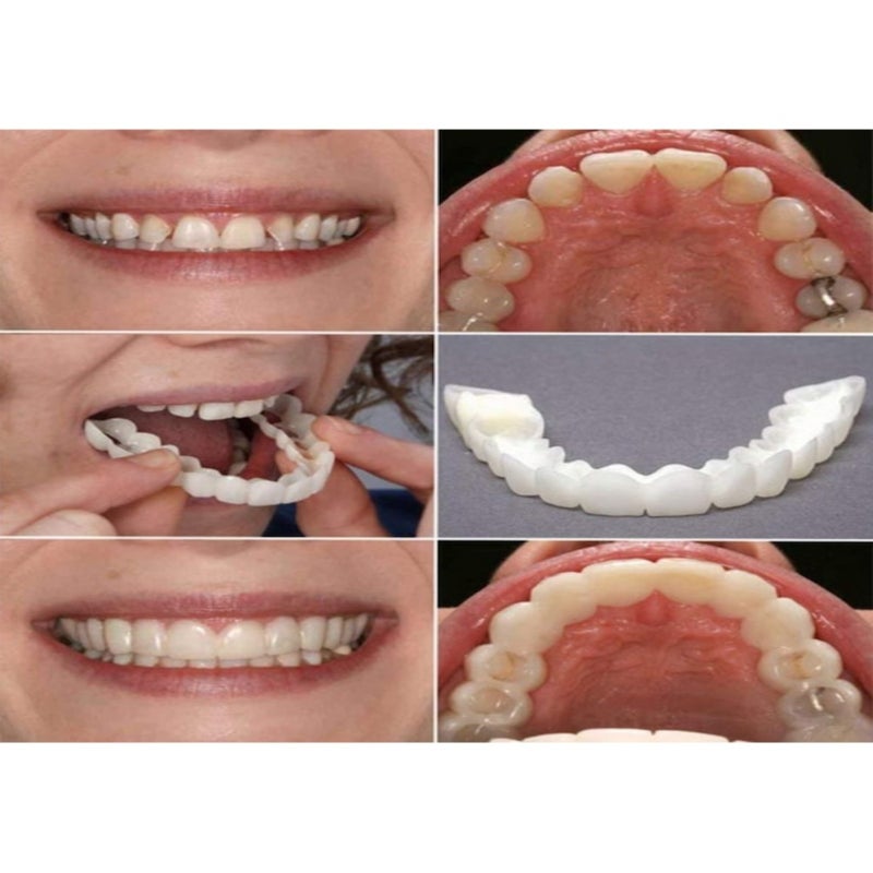 Simulated smile whitening temporary decorative false braces  white - Image 3