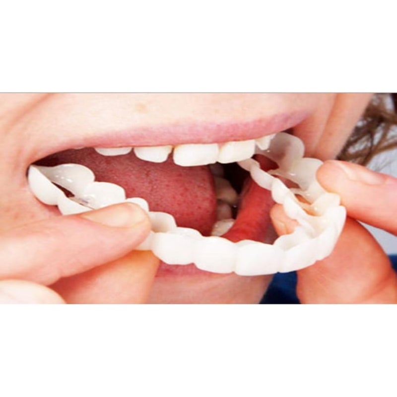 Simulated smile whitening temporary decorative false braces  white - Image 2