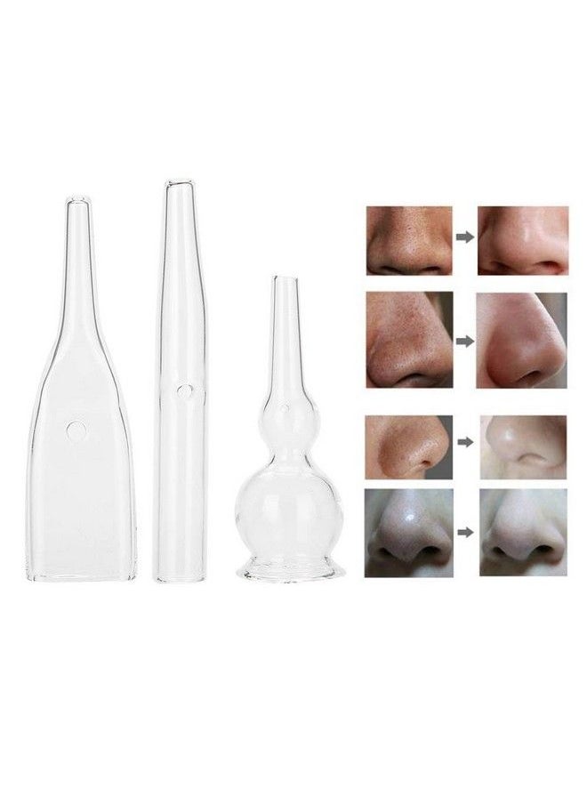 Agatige - 3Pcs Vacuum Glass Tube Kit Blackhead Removal Facial Suction Pore Vacuum Cleaner For Face Cleanser Blackhead Removal Machine Microdermabrasion Machine Accessories - Image 1