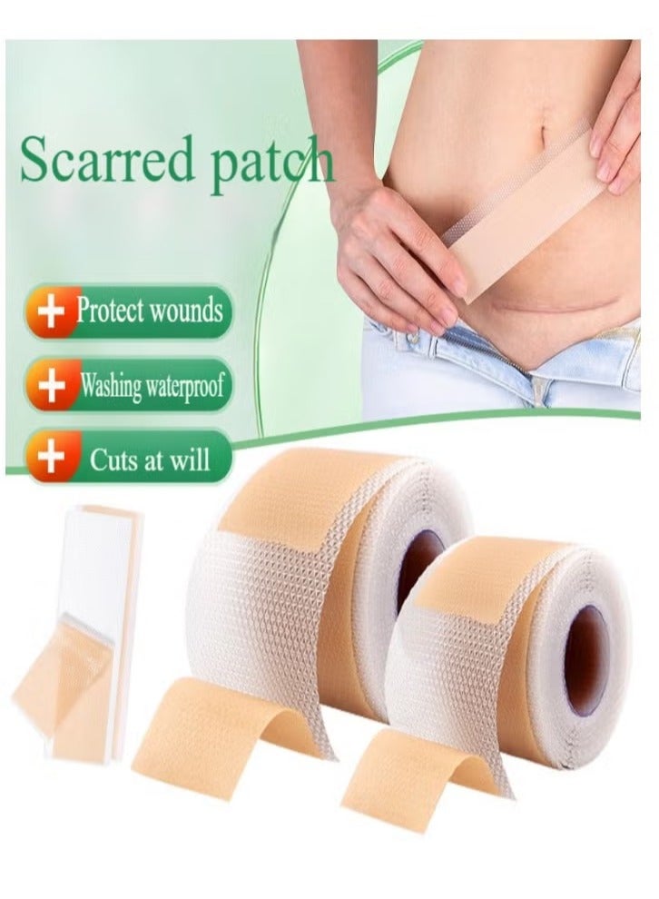 4cm*1.5m Silicone Gel Scar Sticker, Efficient Fade Scar Self-adhesive Skin Tone Patch, for Acne & Burn Scar Care - Image 1