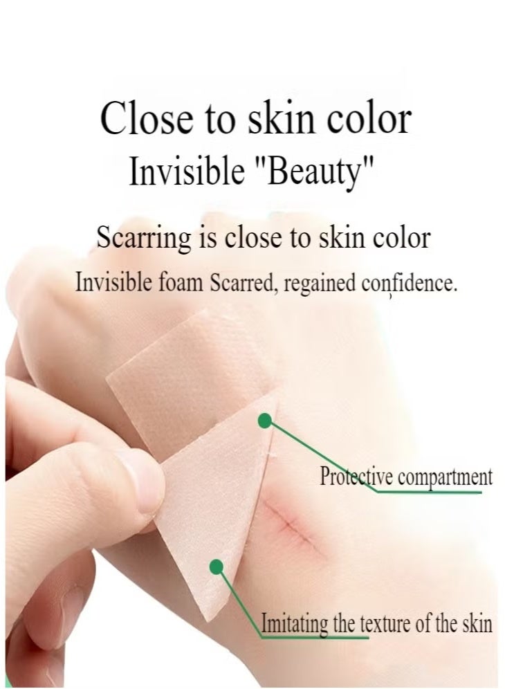 4cm*1.5m Silicone Gel Scar Sticker, Efficient Fade Scar Self-adhesive Skin Tone Patch, for Acne & Burn Scar Care - Image 5