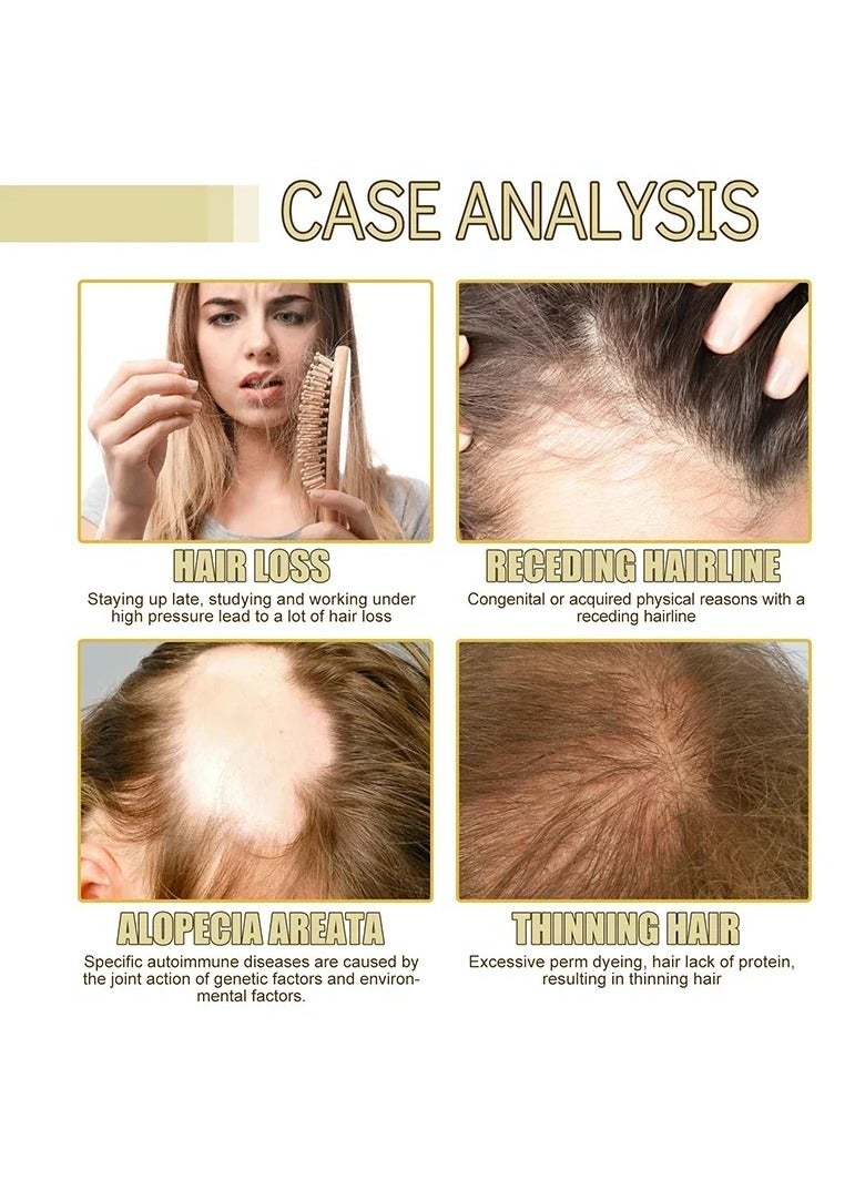 EELHOE زيت نمو الشعر الطبيعي النباتي، زيت الروزماري العضوي لنمو الشعر، زيت نمو الشعر بمكونات طبيعية للشعر الجاف التالف ونمو الشعر الخفيف - Image 4