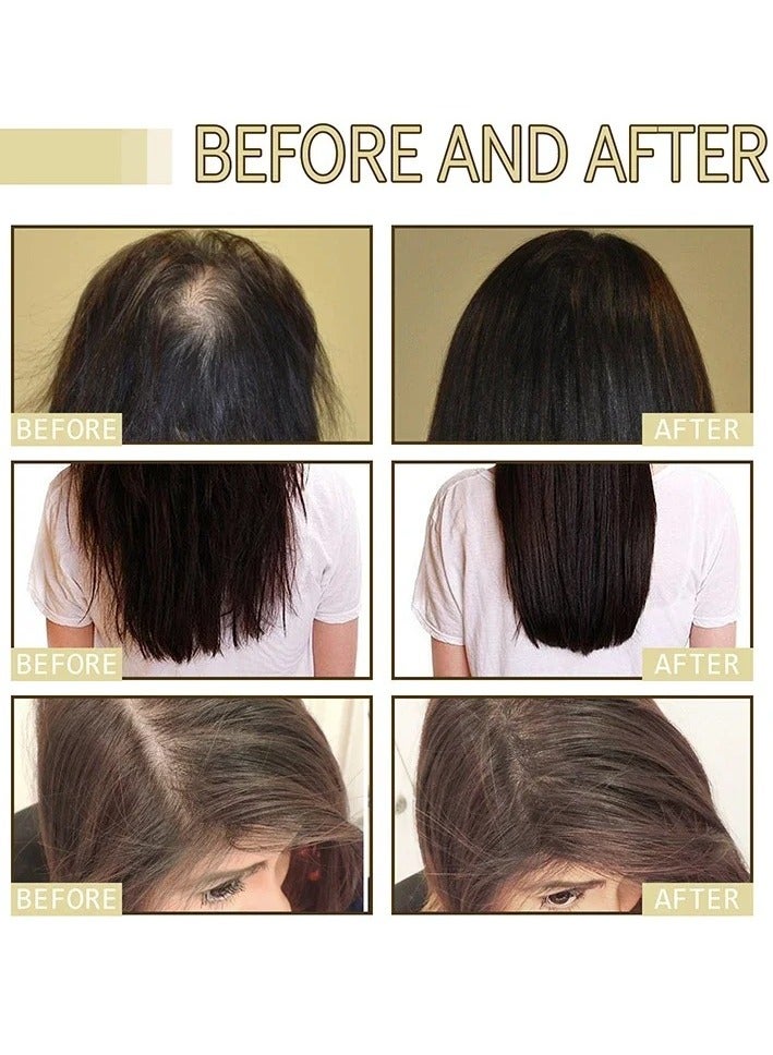 EELHOE زيت نمو الشعر الطبيعي النباتي، زيت الروزماري العضوي لنمو الشعر، زيت نمو الشعر بمكونات طبيعية للشعر الجاف التالف ونمو الشعر الخفيف - Image 3