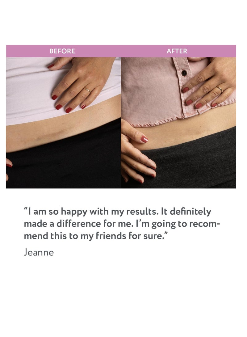 scaraway Advanced Skincare Silicone Scar Sheets For Csections 4 sheets 1 Month Supply - Image 3