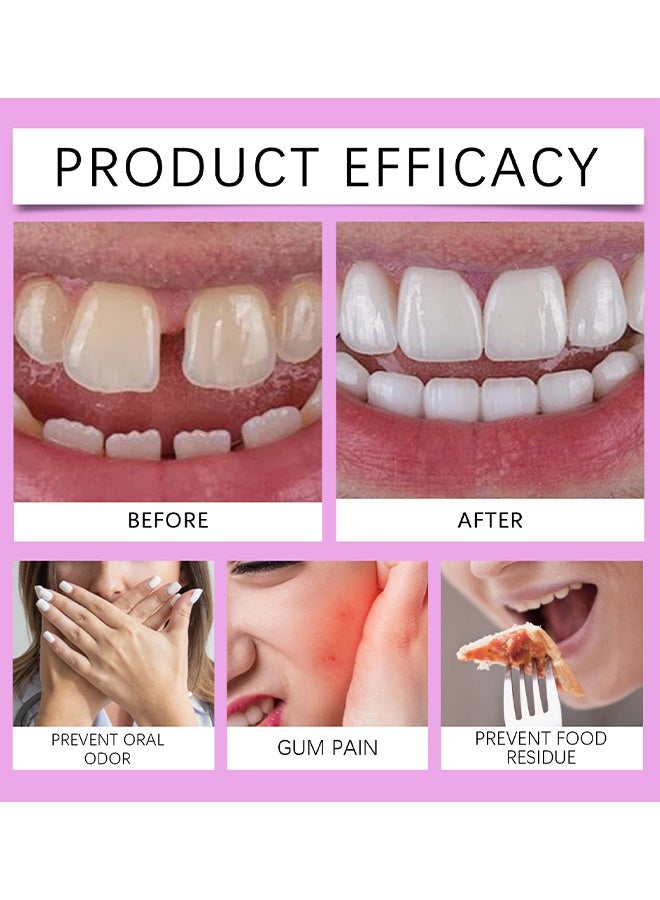 ORALHOE Thermoplastic Denture Adhesives & Cushion, Fixed Denture Adhesives, Dentures Non-Glue Adhesive, Used To Repair And Fasten Loose Dentures, Dental Adhesives For Dentures, Long Holding Denture Reliner, 20G - Image 2
