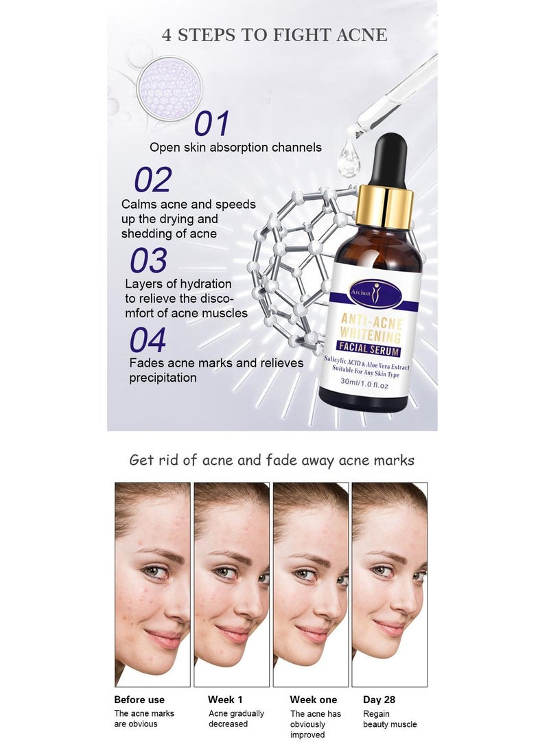 AICHUN Anti-Acne Whitening Facial Serum,Salicylic ACID & Aloe Vera Extract suitable for any skin type - Image 2