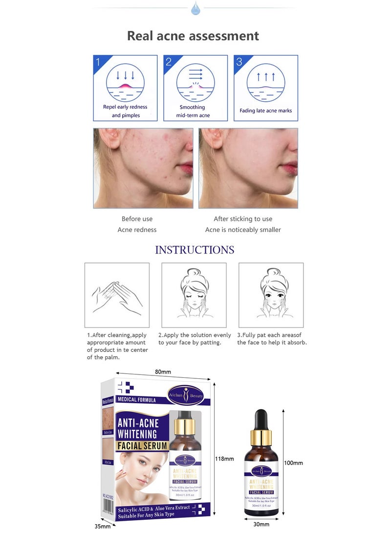 AICHUN Anti-Acne Whitening Facial Serum,Salicylic ACID & Aloe Vera Extract suitable for any skin type - Image 3