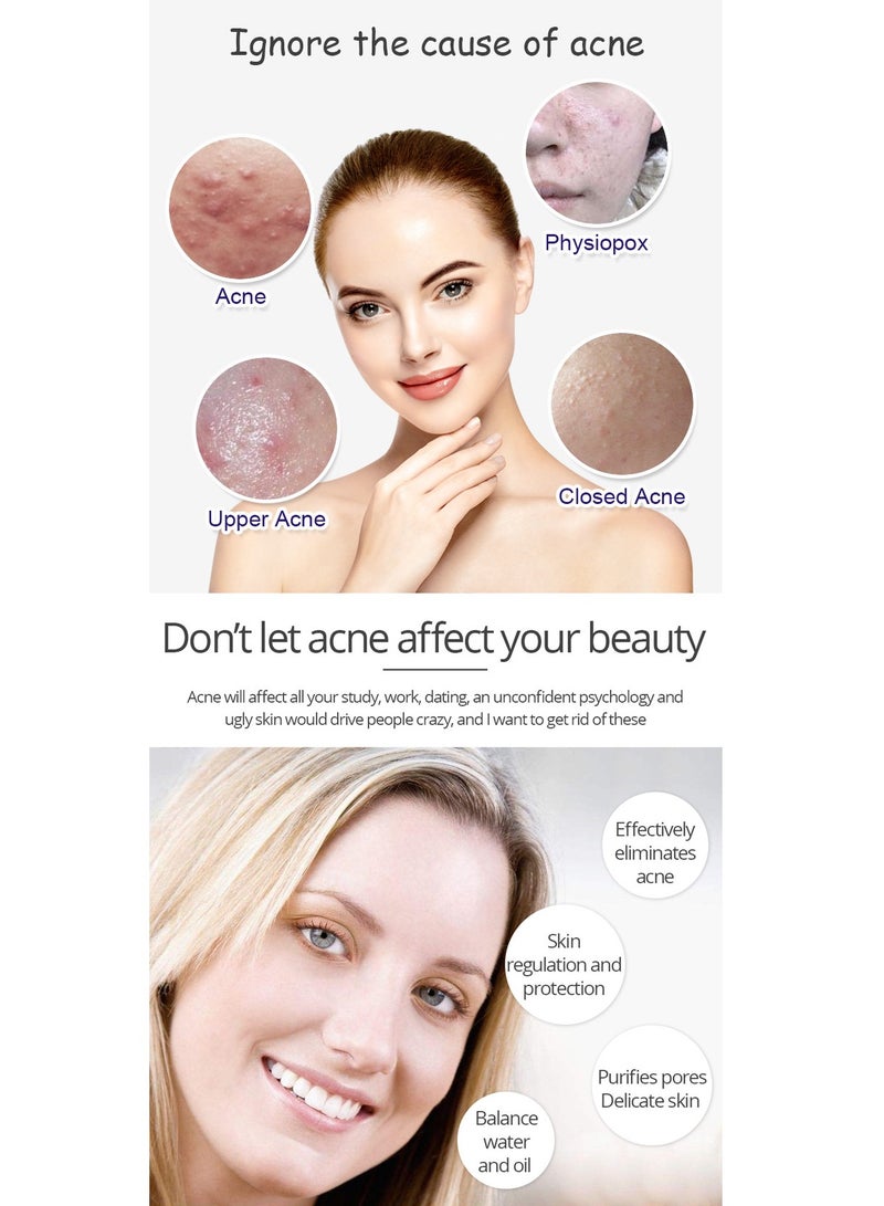AICHUN Anti-Acne Whitening Facial Serum,Salicylic ACID & Aloe Vera Extract suitable for any skin type - Image 5