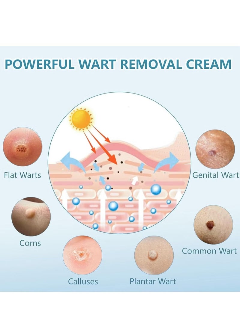 SOUTH MOON 2-PACK Wart Removal Cream,  Wart Remover for Genital Warts, Plantar Warts, Common Warts, Corns, Wart Cream 20g*2 - Image 4