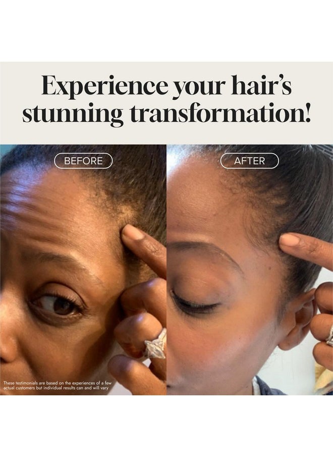 meraz pureauty naturals Biotin Hair Growth Serum Advanced Topical Formula To Help Grow Healthy, Strong Hair Suitable for Men and Women of All Hair Types Hair Loss Support By Pureauty Naturals 2 Fl Oz (Pack of 1)  - Image 4
