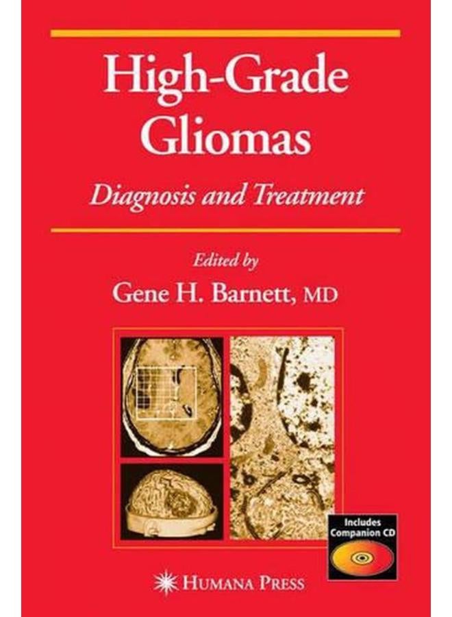 High-Grade Gliomas