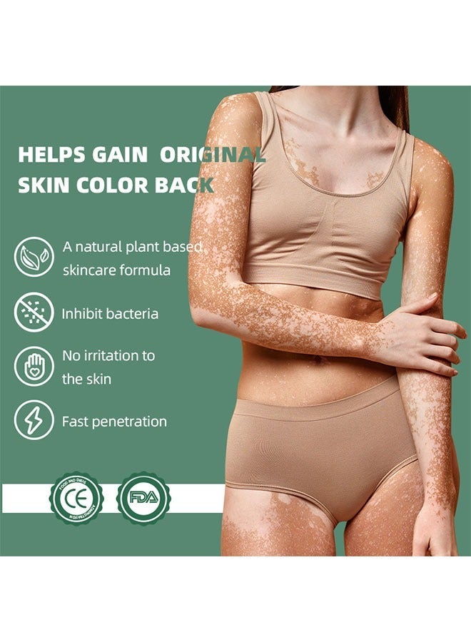 APPTRIN Vitiligo Relief Cream 20G, Treatment for Skin Vitiligo Ointment, Fade White Spot and Improve Skin Pigmentation Cream, Vitiligo Cream for Skin Healthy Care - Image 3