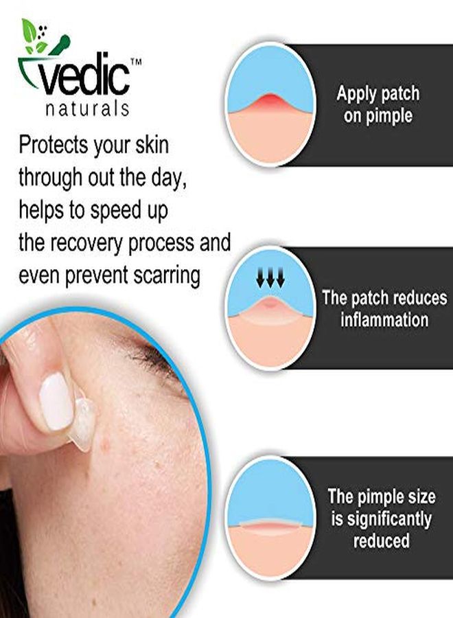 S Acne Pimple Patch For Skin Treatment Cover With 100% Hydrocolloid Transparent Patch Fast Pimple Healing  Free & Non Drying  36 Patches