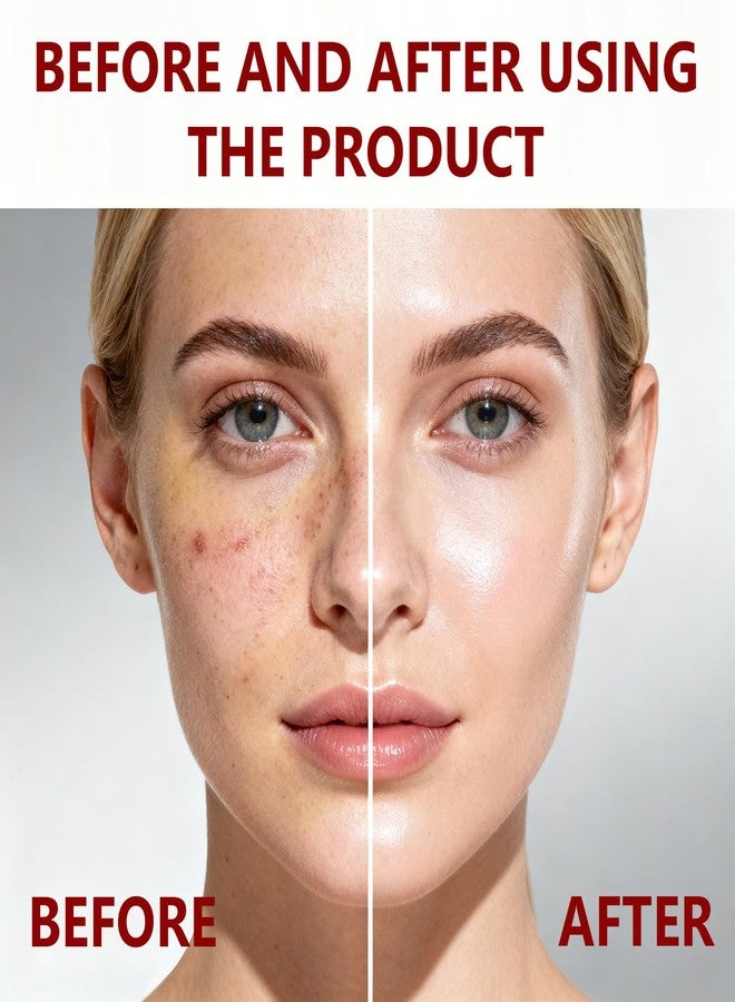 sunohyesla Peel Shot Glow Black Rice Peeling Ampoule,Niacinamide,Salicylic Acid Lessens Blackhead Appearance, Hyaluronic Acid Locks Moisture,Supports Skin Barrier, For Various Skins (2.7 fl oz - Image 4
