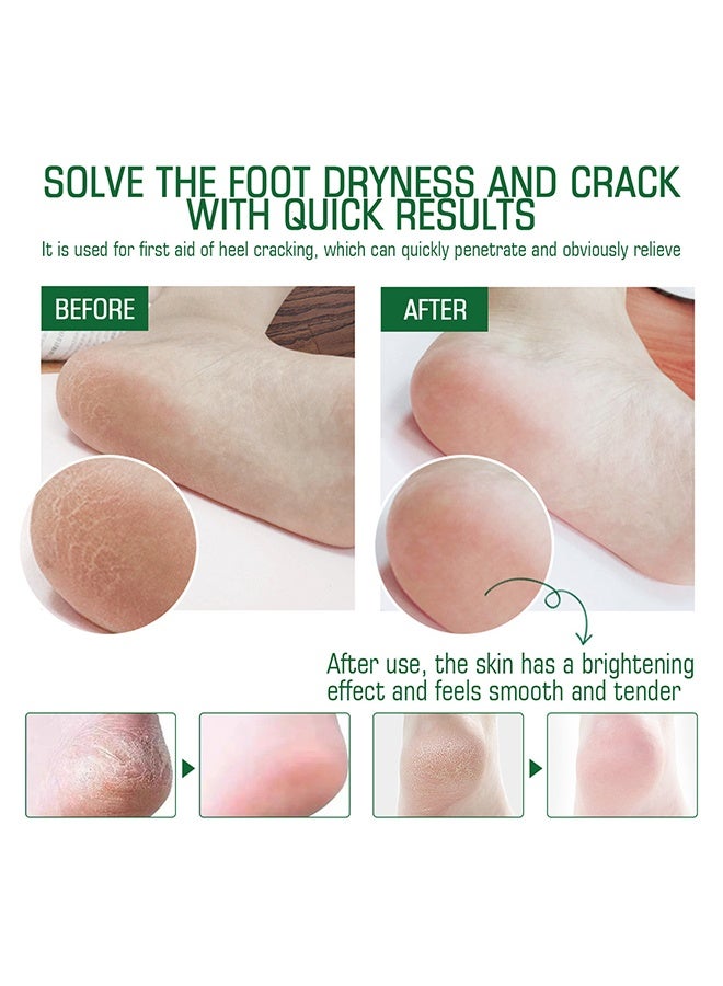 SUMAX Tea Tree Oil Foot Care Cream, Effectively Exfoliate, Deeply Moisturize, Foot Moisture Care Cream for Improve Foot Skin Condition, for Rough /Thick / Dry Cracked Skin 30ml - Image 5