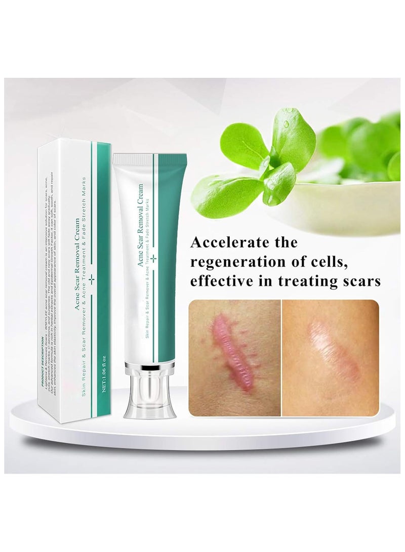 Breylee Acne Scar Removal Cream 30grams - Image 2