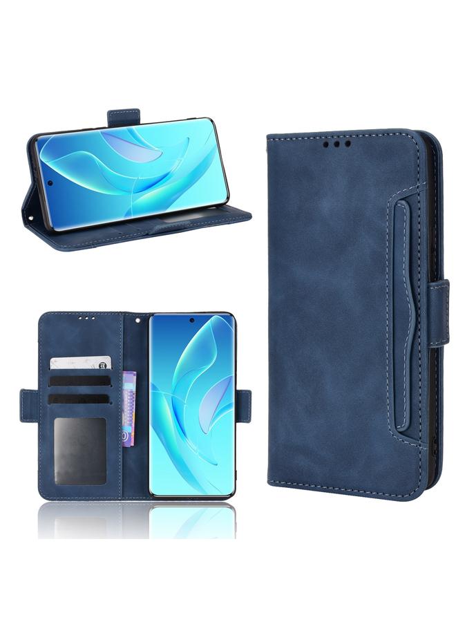 S-TOP Case For Honor 60 Skin Feel Calf Pattern Leather Phone Case - Image 1