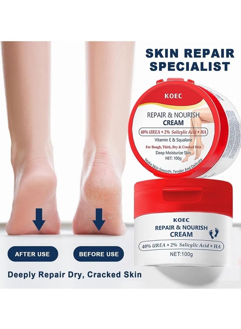 ك أو إي سي nigwete 40 ٪ اليوريا كريم اليد مرطب للبشرة الجافة مع 2 ٪ حمض الصفصاف وحمض الهيالورونيك والكراك تقشر على اليدين والقدمين والمرفقين والأظافر والركبتين من كوربوس كالوسوم - Image 4