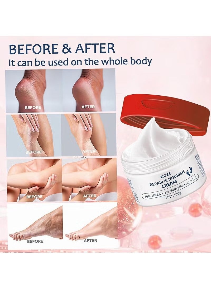 ك أو إي سي nigwete 40 ٪ اليوريا كريم اليد مرطب للبشرة الجافة مع 2 ٪ حمض الصفصاف وحمض الهيالورونيك والكراك تقشر على اليدين والقدمين والمرفقين والأظافر والركبتين من كوربوس كالوسوم - Image 5