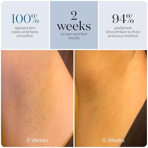 SmoothSkin Pure Adapt Champagne IPL Hair Removal Device, At-Home Laser Hair Removal for Women & Men, Visible Results in 2 Weeks, Safe for Face & Body, Long-Lasting Hair Reduction, Full Body Use - Image 5