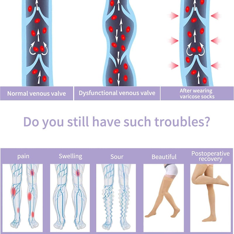 Athbavib 20-30mmHg Thigh High Compression Stockings for Women & Men, Closed Toe Medical Compression Socks Graduated Support Compression Sock for Varicose Veins Swelling Treatment - Image 3