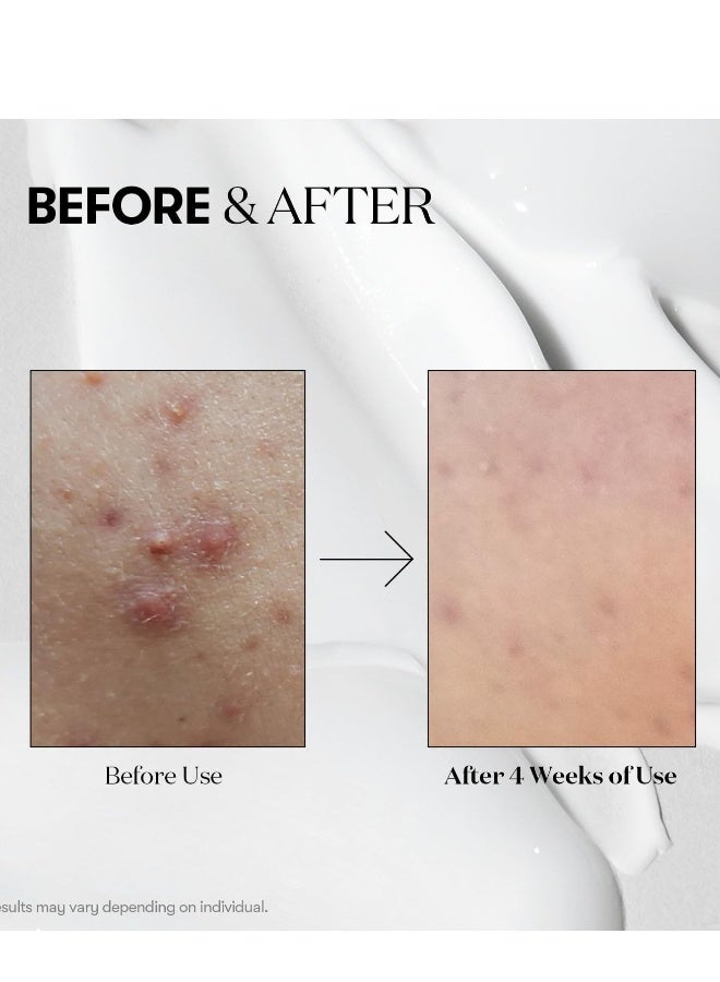 VT COSMETICS CICA Reedle Shot 100 Essence | Daily Face Essence for Soft Skin, Centella Complex, Hyaluronic Acid, Green Propolis Extract for All Skin Types 1.69Fl Oz (50ml) - Image 4