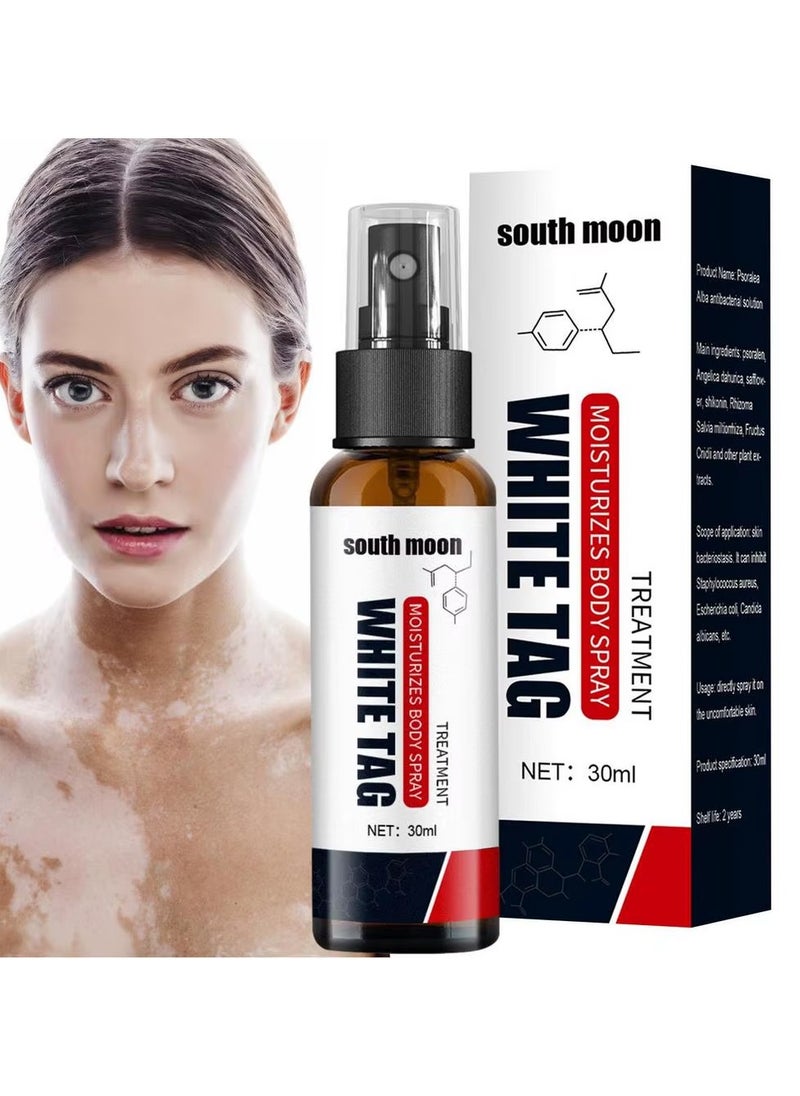 SOUTH MOON New White Spot Remover Spray 30ml Herbal Extract Vitiligo Disease Repair Vitiligo Treatment Spray  - Image 1