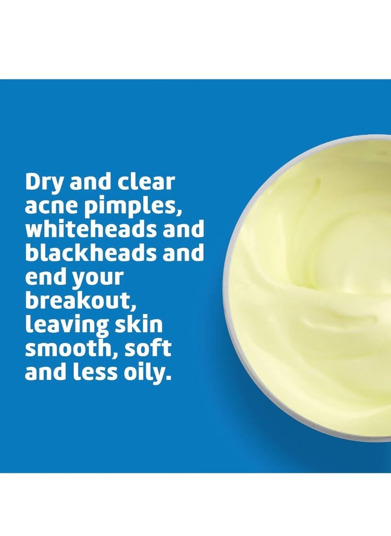 Maximum Strength Acne Treatment With 10 % Sulfur 73.7 g