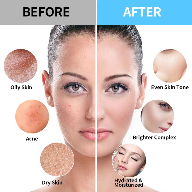 Nielies Jelly Face Mask for Facials - Hyaluronic Acid Hydrating Nourishing Jelly Mask | Vajacial Jelly Mask Powder | 23 Oz Jar - Image 5