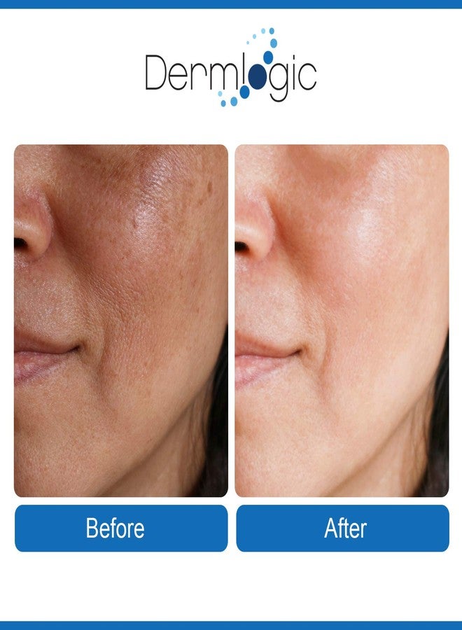 Dermlogic Anti Aging Resurfacing Peel Pads- Triple Action Chemical Peel Pads Combined with Glycolic, Lactic, and Salicylic Acids. Smooth’s Fine Lines, Wrinkles, Dark Spots, and Imperfections to Enhance the Skin - Image 3