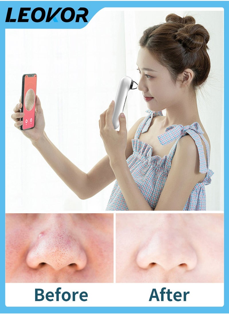 LEOKOR - Blackhead Remover Vacuum Pore Cleaner with Cameta 30x Real Time Monitoring Upgraded Visual Facial Pore Cleaner Blue Light Therapy - Image 1
