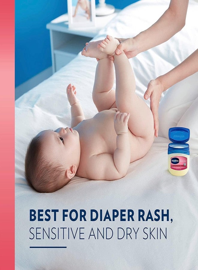Vaseline Petroleum Jelly Baby Skincare Protective & Pure 4 Count Treats Dry Skin And Prevents Chaffed Skin From Diaper Rash Hypoallergenic And Gentle On Skin 13oz - Image 3