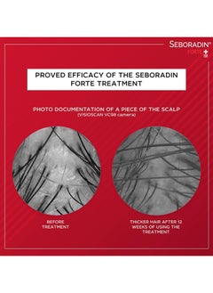 Seboradin Forte ampoules for the treatment of chronic hair loss and hair loss  - Image 4