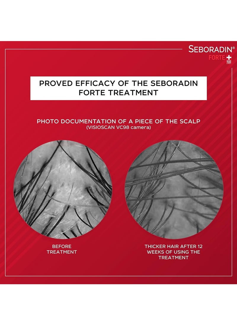 Seboradin Forte ampoules for the treatment of chronic hair loss and hair loss  - Image 4