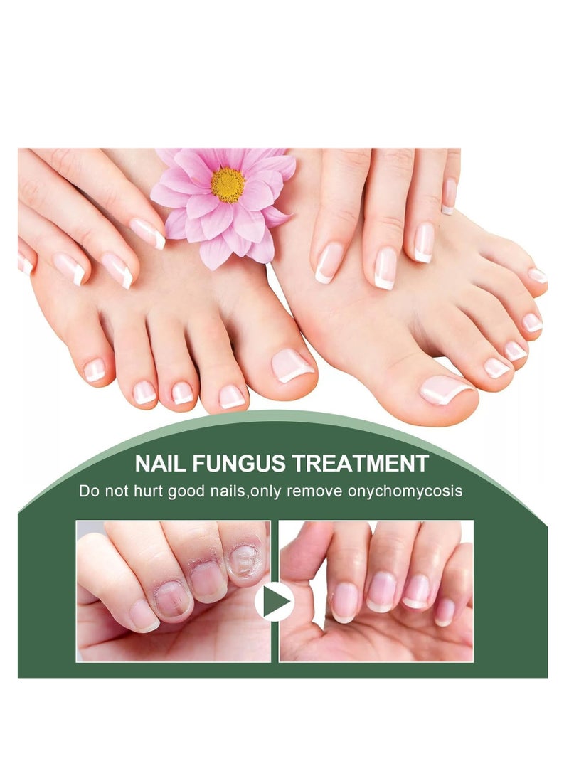 إيلهو علاج فطريات أظافر القدم ، علاج الأظافر الفطرية القوية للغاية ، إصلاح الأظافر المضادة للفطريات وتقوية الزيت ، إصلاح الأظافر الضعيفة والتالفة ، علاج الأظافر الآمن واللطيف 30 مل - Image 2