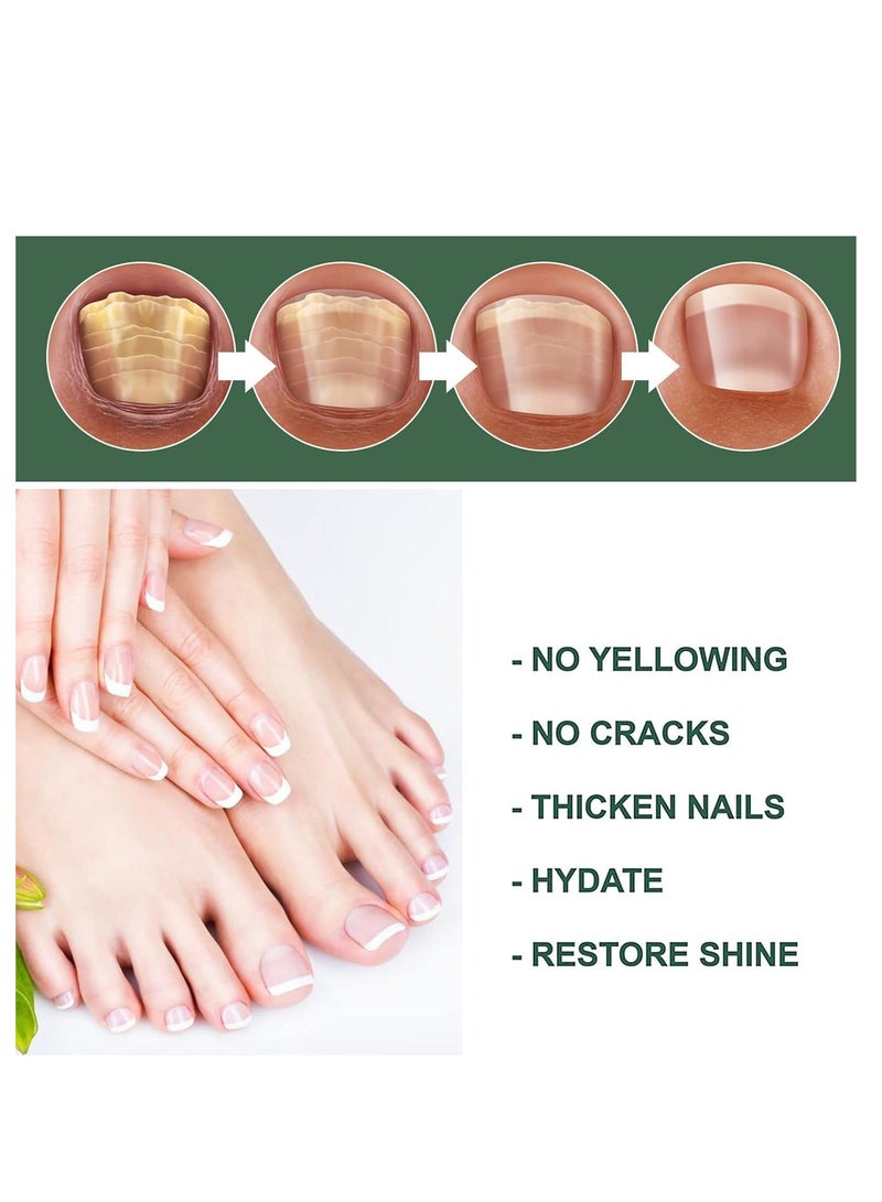 إيلهو علاج فطريات أظافر القدم ، علاج الأظافر الفطرية القوية للغاية ، إصلاح الأظافر المضادة للفطريات وتقوية الزيت ، إصلاح الأظافر الضعيفة والتالفة ، علاج الأظافر الآمن واللطيف 30 مل - Image 3