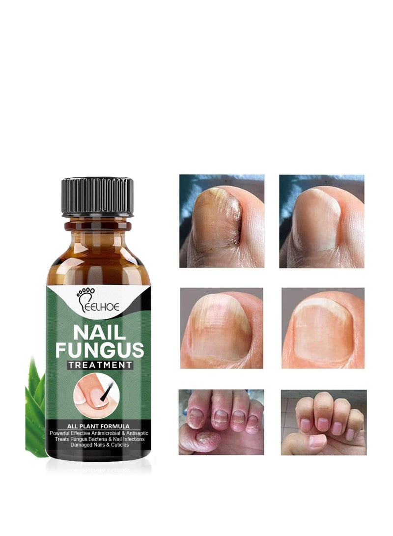 إيلهو علاج فطريات أظافر القدم ، علاج الأظافر الفطرية القوية للغاية ، إصلاح الأظافر المضادة للفطريات وتقوية الزيت ، إصلاح الأظافر الضعيفة والتالفة ، علاج الأظافر الآمن واللطيف 30 مل - Image 5