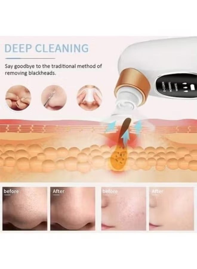 Super Micro Bubble Beauty Instrument, Blackhead Remover Pore Vacuum Cleaner, Facial Pore Cleaner with 3 Suction Powers, Blackhead Extraction Tool for Deep Cleansing and Exfoliation - Image 2