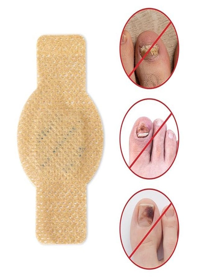 Flair Fusion New Nail Patches, 10PCS Nail Treatment Patches, Multi-Purpose Toenail Repair Treatment Pads, Toenail Patches, Antifungal Nail Treatment - Image 2