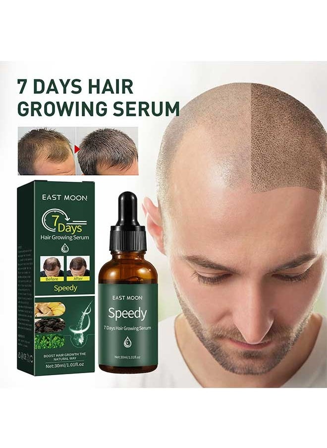 East Moon - 7 Days Ginger Hair Growing Serum 30ml, Rapid Growth Hair Treatment, Anti Hair Loss Hair Regrowth Essence, Nourishing Hair Care Essential Oil - Image 1