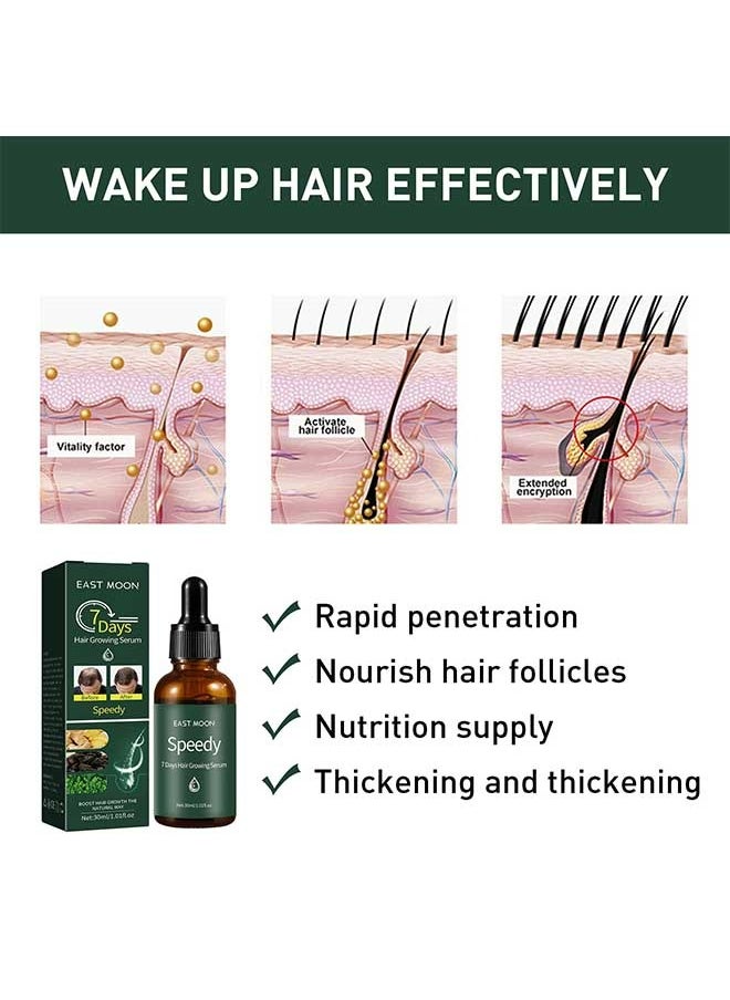 East Moon - 7 Days Ginger Hair Growing Serum 30ml, Rapid Growth Hair Treatment, Anti Hair Loss Hair Regrowth Essence, Nourishing Hair Care Essential Oil - Image 1