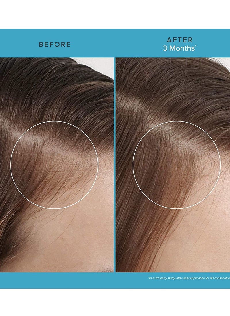 Living Proof - Living Proof Scalp Care Revitalizing Treatment - Image 1