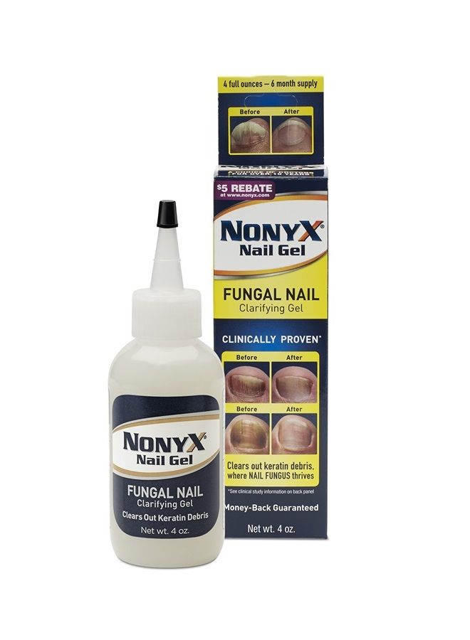 Nonyx Nail Gel, 4.0 OZ (2 Pack)