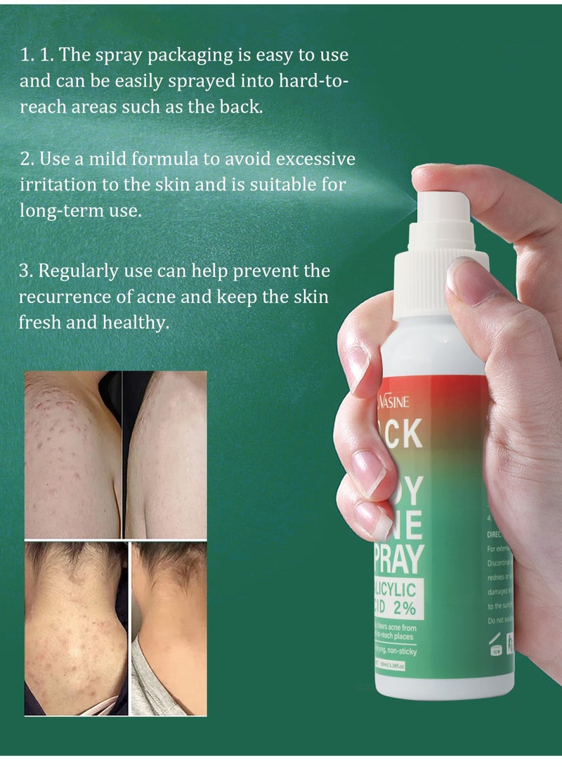SAUVASINE Back & Body Acne Treatment Spray, Gentle Oil Control for Acne, Redness Relief, Smooth Skin, Cleans Pores, Moisturizes, Quick Dry Formula for All Skin Types (100ml) - Image 3