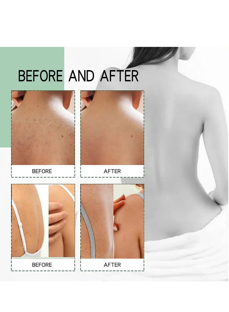 SAUVASINE Back & Body Acne Treatment Spray, Gentle Oil Control for Acne, Redness Relief, Smooth Skin, Cleans Pores, Moisturizes, Quick Dry Formula for All Skin Types (100ml) - Image 5