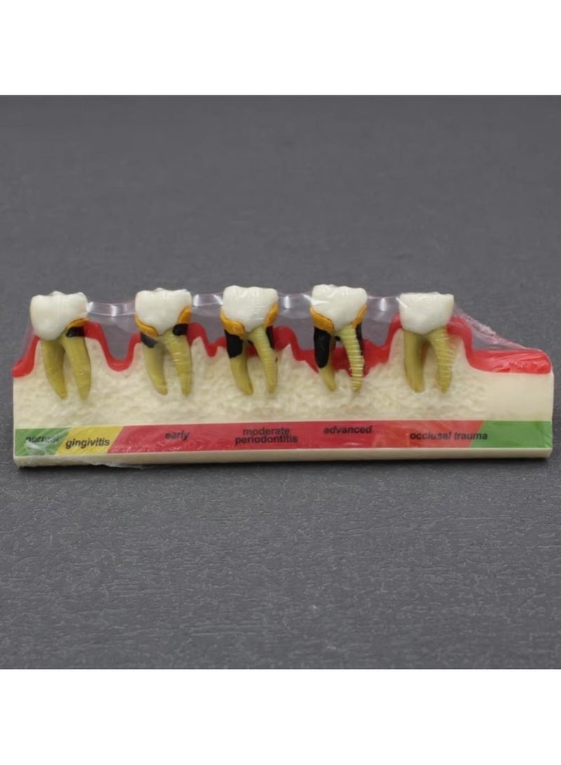 Dental Periodontal Teaching Model