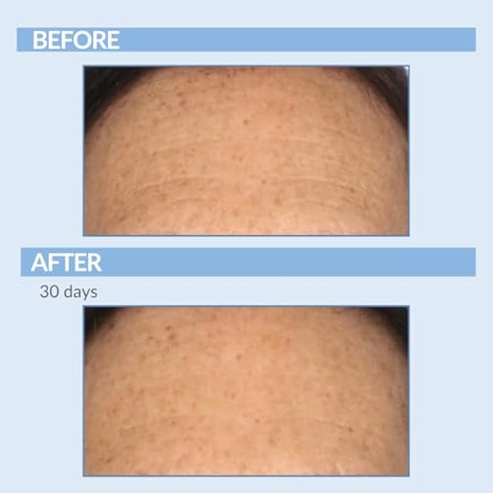 Serious Skincare Retinol Cream For Face - Vitamin A Cream XR Premium Moisturizer - Anti-Aging - Day & Night - Reduce Fine Lines & Wrinkles - For Radiant Skin 2 Fl. Oz. - Image 4