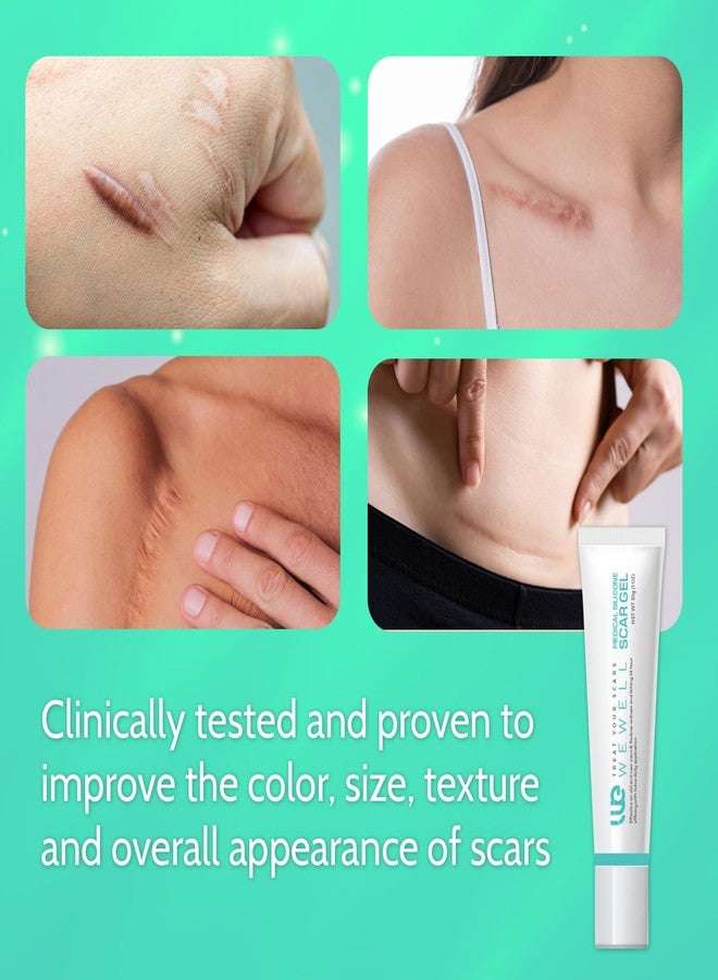 Wewell Scar Cream for Keloid Bump Removal: Professional Silicone Gel for Keloids, Acne Scars, Stretch Marks, C-Section & Burn Marks – Old & New Scar Care Treatment, 1 oz - Image 3