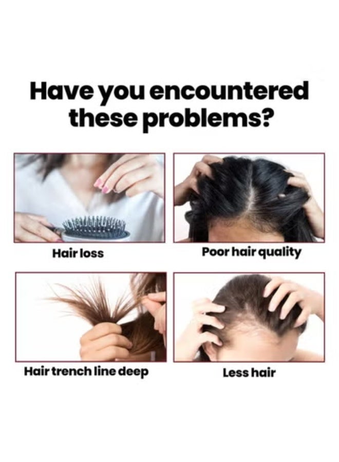 OUHOE OUHOE Hair Root Nourishing, Fast Hair Growth, Anti-Hair Loss, Strong Hair, Strengthening Hair Care Essence 50ml*3 - Image 2