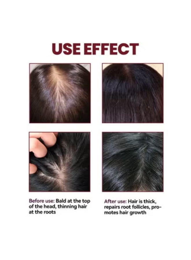 OUHOE OUHOE Hair Root Nourishing, Fast Hair Growth, Anti-Hair Loss, Strong Hair, Strengthening Hair Care Essence 50ml*3 - Image 5